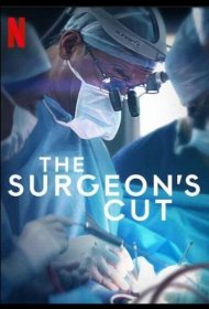 Постер Сериала На острие скальпеля